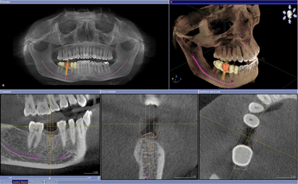 Radiographie En 3D Gratuit | Calculatrice 3D – SUGUH